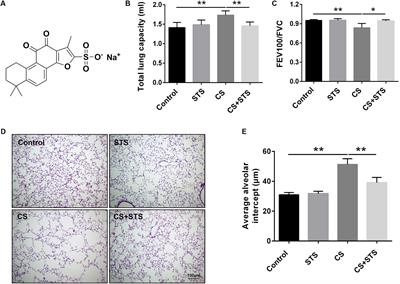 Sodium Tanshinone IIA Sulfonate Decreases Cigarette Smoke-Induced Inflammation and Oxidative Stress via Blocking the Activation of MAPK/HIF-1α Signaling Pathway